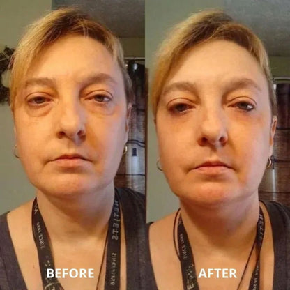 Peptide collagen hydrogel EyePatch