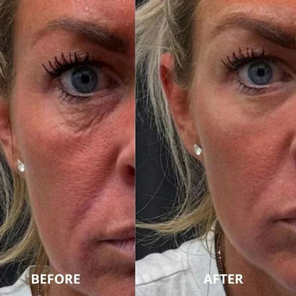 Peptide collagen hydrogel EyePatch