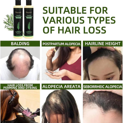 Nourishing Rosemary Shampoo for Stronger Hair