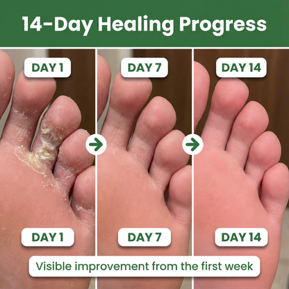 Nayori® AntiFungal Relief Soap Bar