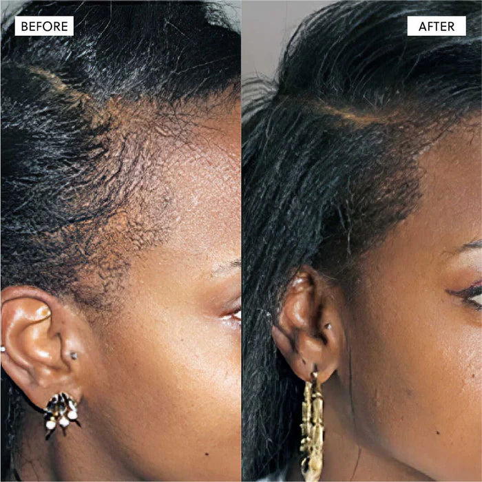 files/HairgrowthSerum7_17e963b3-6a0c-48af-bcfe-f341410e655b.webp